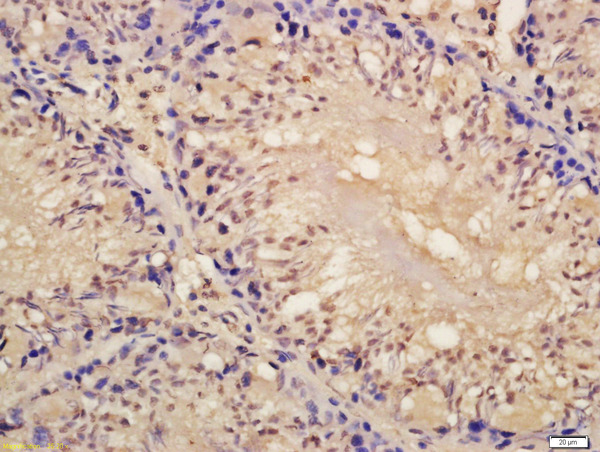 Formalin-fixed and paraffin embedded mouse placenta labeled with Rabbit Anti-Lin28 Polyclonal Antibody, Unconjugated (bs-8443R) at 1:200 followed by conjugation to the secondary antibody and DAB staining\n