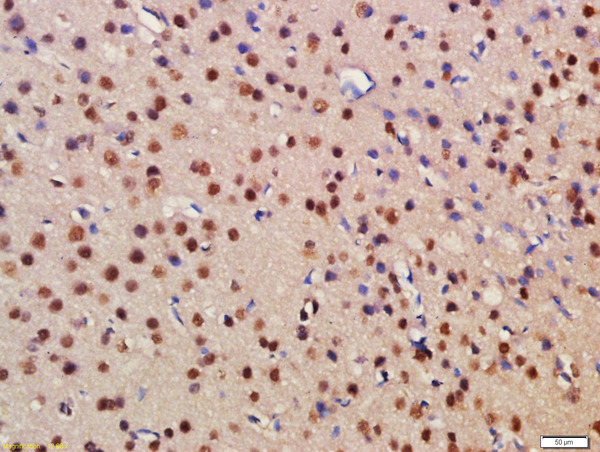 Formalin-fixed and paraffin embedded rat brain labeled with Rabbit Anti-BRD1 Polyclonal Antibody, Unconjugated (bs-8426R) at 1:200 followed by conjugation to the secondary antibody and DAB staining\n