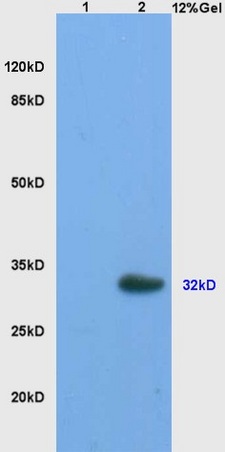 L1 mouse ovary lysates L2 mouse brain lysates probed with Anti StAR/StARD1 Polyclonal Antibody, Unconjugated (bs-3570R) at 1:200 overnight at 4˚C. Followed by conjugation to secondary antibody (bs-0295G-HRP) at 1:3000 for 90 min at 37˚C. Predicted band 32kD. Observed band size:32kD.\n