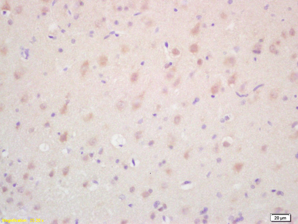 Formalin-fixed and paraffin embedded rat brain labeled with Rabbit Anti TAK1/MAP3K7 Polyclonal Antibody, Unconjugated (bs-3585R) at 1:200 followed by conjugation to the secondary antibody and DAB staining