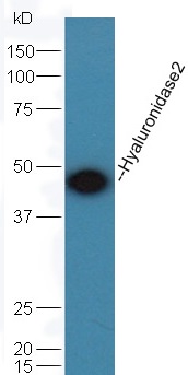 Mouse testis lysate probed with Rabbit Anti-Hyaluronidase 2 Polyclonal Antibody (bs-5888R) at 1:300 overnight in 4˚C. Followed by conjugation to the secondary antibody (bs-0295G-HRP) at 1:5000 90min in 37˚C.