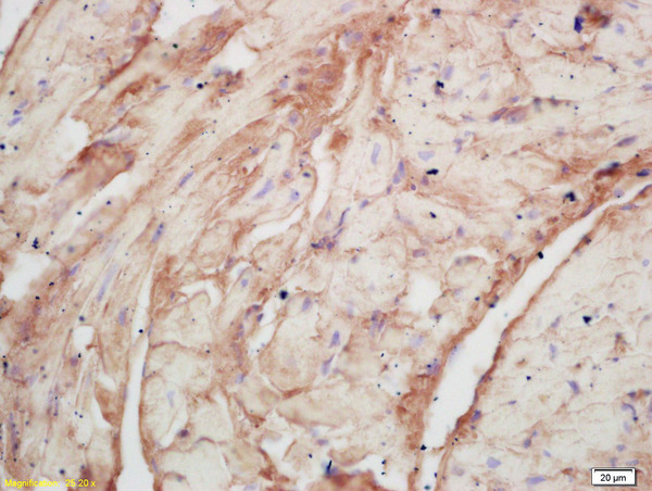 Formalin-fixed and paraffin embedded rat cardiac muscle labeled with Rabbit Anti PLASTIN3/T Plastin Polyclonal Antibody, Unconjugated (bs-3643R) at 1:200 followed by conjugation to the secondary antibody and DAB staining