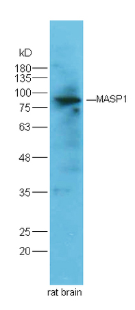 Rat brain lysates probed with Rabbit Anti-MASP Polyclonal Antibody (bs-1723R) at 1:300 overnight in 4˚C. Followed by conjugation to the secondary antibody (bs-0295G-HRP) at 1:5000 90min in 37˚C.