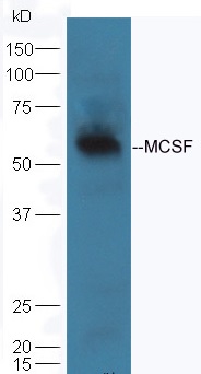 Mouse lung lysate probed with Rabbit Anti-MCSF Polyclonal Antibody (bs-4910R) at 1:300 overnight in 4˚C. Followed by conjugation to the secondary antibody (bs-0295G-HRP) at 1:5000 90min in 37˚C Mouse lung lysate probed with Rabbit Anti-MCSF Polyclonal Antibody (bs-4910R) at 1:300 overnight in 4˚C. Followed by conjugation to the secondary antibody (bs-0295G-HRP) at 1:5000 90min in 37˚C