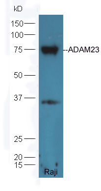 Raji lysate probed with Rabbit Anti-ADAM23 Polyclonal Antibody (bs-5853R) at 1:300 overnight in 4˚C. Followed by conjugation to the secondary antibody (bs-0295G-HRP) at 1:5000 90min in 37˚C