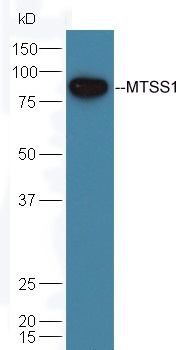 Mouse testicular lysate probed with Rabbit Anti-MTSS1 Polyclonal Antibody (bs-6075R) at 1:300 overnight in 4˚C. Followed by conjugation to the secondary antibody (bs-0295G-HRP) at 1:5000 90min in 37˚C