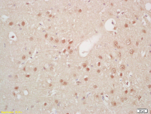 Formalin-fixed and paraffin embedded rat brain labeled with Rabbit Anti Hes5 Polyclonal Antibody, Unconjugated (bs-3767R) at 1:200 followed by conjugation to the secondary antibody and DAB staining