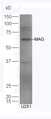 U251 lysates probed with Rabbit Anti-MAG Polyclonal Antibody, Unconjugated (bs-0257R) at 1:300 overnight at 4˚C. Followed by a conjugated secondary antibody (bs-0295G-HRP) at 1:5000 for 90 min at 37˚C.