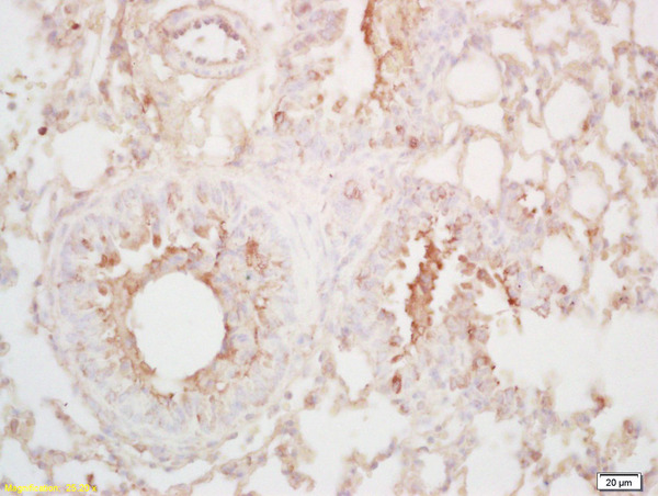 Formalin-fixed and paraffin embedded mouse lung labeled with Rabbit Anti LTA4H Polyclonal Antibody, Unconjugated (bs-3908R) at 1:200 followed by conjugation to the secondary antibody and DAB staining