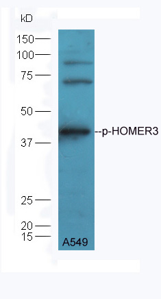 A549 lysate probed with Rabbit Anti-HOMER3 (Thr36) Polyclonal Antibody (bs-5392R) at 1:300 overnight in 4˚C. Followed by conjugation to the secondary antibody (bs-0295G-HRP) at 1:5000 90min in 37˚C.