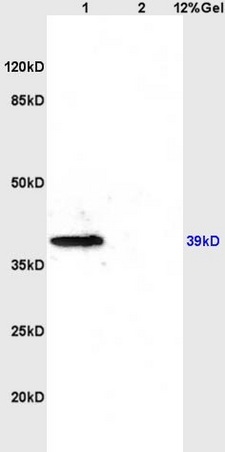 L1 rat brain lysates L2 rat kidney lysates probed with Anti- CD184/CXCR4 Polyclonal Antibody, Unconjugated (bs-1011R) at 1:200 overnight at 4˚C. Followed by conjugation to secondary antibody (bs-0295G-HRP) at 1:3000 for 90 min at 37˚C. Predicted band 39kD.Observed band 39kD