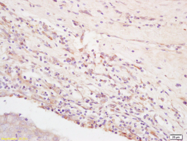 Formalin-fixed and paraffin embedded rat brain labeled with  Rabbit Anti Integrin Alpha V + Beta 3 (CD51+CD61)Polyclonal Antibody, Unconjugated (bs-1310R) at 1:200 followed by conjugation to the secondary antibody and DAB staining