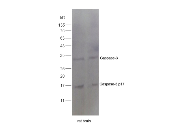 Rat lung lysate 30ug, probed (bs-0081R) at 1:200 overnight in 4˚C. Followed by conjugation to the secondary antibody (bs-0295G-HRP) at 1:3000 90min in 37˚C. Predicted and observed band size: 17kDa,33kD
