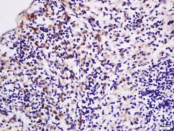 Formalin-fixed and paraffin embedded rat spleen labeled with Rabbit Anti-LPA2 Polyclonal Antibody, Unconjugated (bs-10368R) at 1:200 followed by conjugation to the secondary antibody and DAB staining\n
