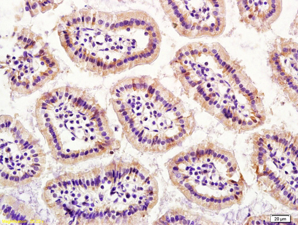 Formalin-fixed and paraffin embedded mouse small intestine labeled with Rabbit Anti S100A4 Polyclonal Antibody, Unconjugated (bs-3759R) at 1:200 followed by conjugation to the secondary antibody and DAB staining