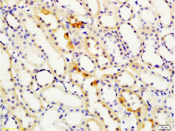 Formalin-fixed and paraffin embedded rat kidney labeled with  Rabbit Anti S100A4 Polyclonal Antibody, Unconjugated (bs-3759R) at 1:200 followed by conjugation to the secondary antibody and DAB staining