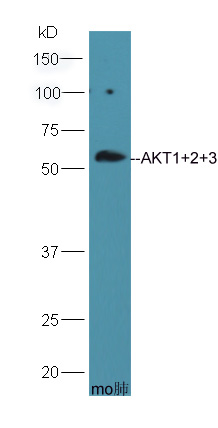 HepG2 lysate probed with Rabbit Anti-AKT1+2+3 Polyclonal Antibody (bs-6951R) at 1:300 overnight in 4˚C. Followed by conjugation to the secondary antibody (bs-0295G-HRP) at 1:5000 90min in 37˚C.