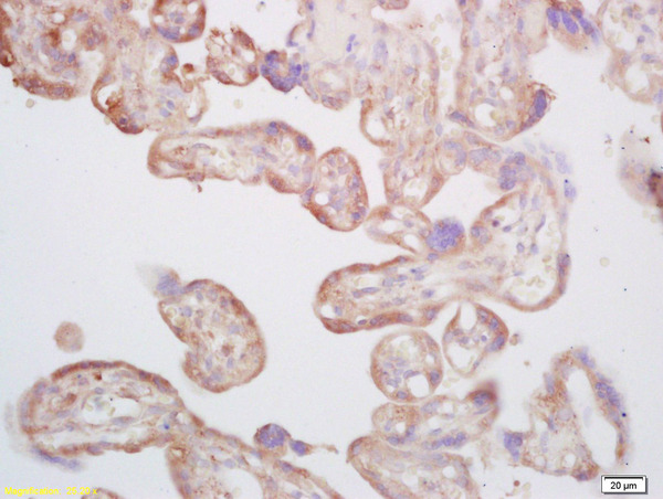 Formalin-fixed and paraffin embedded human placenta labeled with Rabbit Anti CYP5A1/Thromboxane synthase Polyclonal Antibody, Unconjugated (bs-4019R) at 1:200 followed by conjugation to the secondary antibody and DAB staining