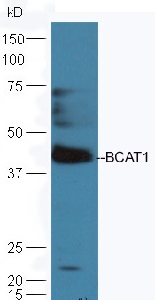 Mouse brain lysates probed with Rabbit Anti-BCAT1 Polyclonal Antibody (bs-6613R) at 1:300 overnight in 4˚C. Followed by conjugation to the secondary antibody (bs-0295G-HRP) at 1:5000 90min in 37˚C.