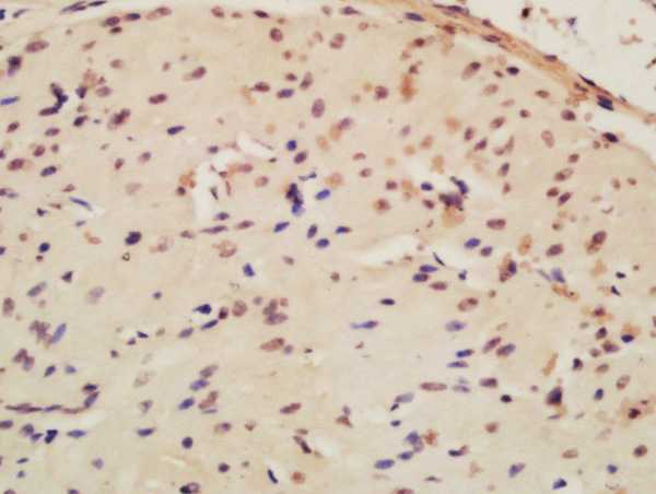 Formalin-fixed and paraffin embedded rat ovary labeled with Rabbit Anti-Cyclin A1 Polyclonal Antibody, Unconjugated (bs-5739R) at 1:200 followed by conjugation to the secondary antibody and DAB staining\n