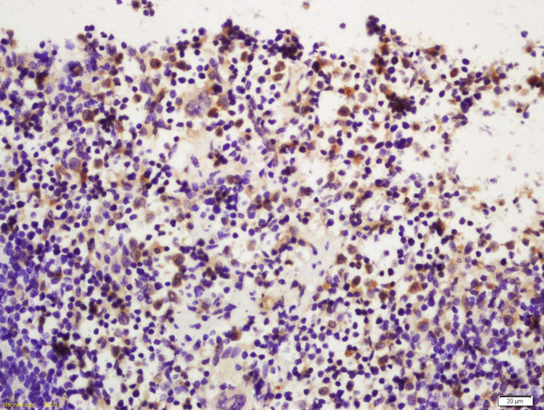 Formalin-fixed and paraffin embedded mouse spleen labeled with Rabbit Anti-PI 3 Kinase p110 delta (Tyr524) Polyclonal Antibody (bs-5587R) at 1:200 followed by conjugation to the secondary antibody and DAB staining