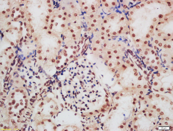 Formalin-fixed and paraffin embedded rat kidney labeled with Rabbit Anti-CDKN1A (Ser130) Polyclonal Antibody, Unconjugated (bs-5274R) at 1:200 followed by conjugation to the secondary antibody and DAB staining\n