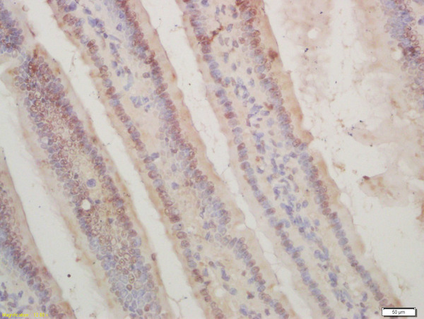 Formalin-fixed and paraffin embedded mouse intestine labeled with Rabbit Anti-CDKN1A (Ser130) Polyclonal Antibody, Unconjugated (bs-5274R) at 1:200 followed by conjugation to the secondary antibody and DAB staining\n