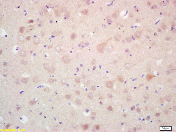 Formalin-fixed and paraffin embedded rat brain labeled with Rabbit Anti MAP LC3 Beta Polyclonal Antibody, Unconjugated (bs-4309R) at 1:200 followed by conjugation to the secondary antibody and DAB staining