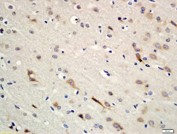 Formalin-fixed and paraffin embedded rat brain tissue labeled with Rabbit Anti-Erbin Polyclonal Antibody, Unconjugated (bs-14619R) at 1:200 followed by conjugation to the secondary antibody and DAB staining \n
