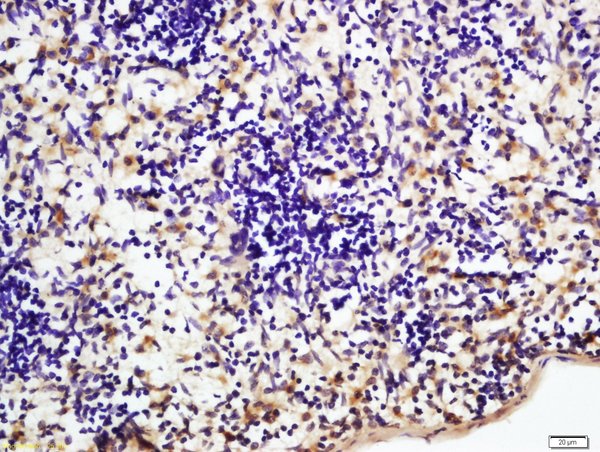 Formalin-fixed and paraffin embedded rat spleen labeled with Rabbit Anti-NFKB p65 Polyclonal Antibody, Unconjugated (bs-0465R) at 1:200 followed by conjugation to the secondary antibody and DAB staining