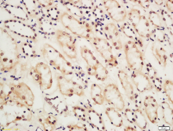 Formalin-fixed and paraffin embedded rat kidney tissue labeled with Rabbit Anti-ERCC6 Polyclonal Antibody, Unconjugated (bs-14082R) at 1:200 followed by conjugation to the secondary antibody and DAB staining