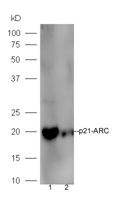 Line1,mouse intestinal lysate; Line2, Raji lysate probed with Rabbit Anti-p21-ARC Polyclonal Antibody, Unconjugated (bs-17589R) at 1:300 in 4˚C. Followed by conjugation to secondary antibody (bs-0295G-HRP) at 1:5000 90min in 37˚C. Line1,mouse intestinal lysate; Line2, Raji lysate probed with Rabbit Anti-p21-ARC Polyclonal Antibody, Unconjugated (bs-17589R) at 1:300 in 4˚C. Followed by conjugation to secondary antibody (bs-0295G-HRP) at 1:5000 90min in 37˚C.