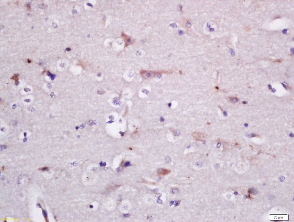Formalin-fixed and paraffin embedded rat brain labeled with Rabbit Anti-GADD34 Polyclonal Antibody, Unconjugated (bs-10287R) at 1:200 followed by conjugation to the secondary antibody and DAB staining