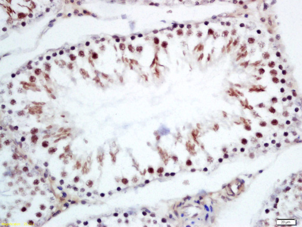 Formalin-fixed and paraffin embedded rat testies labeled with Rabbit Anti-CRNKL1 Polyclonal Antibody, Unconjugated (bs-14065R) at 1:200 followed by conjugation to the secondary antibody and DAB staining