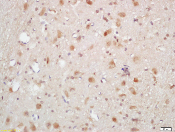 Formalin-fixed and paraffin embedded rat brain labeled with Rabbit Anti-AKT1/2/3 (Thr305/308/309) Polyclonal Antibody, Unconjugated (bs-5182R) at 1:200 followed by conjugation to the secondary antibody and DAB staining