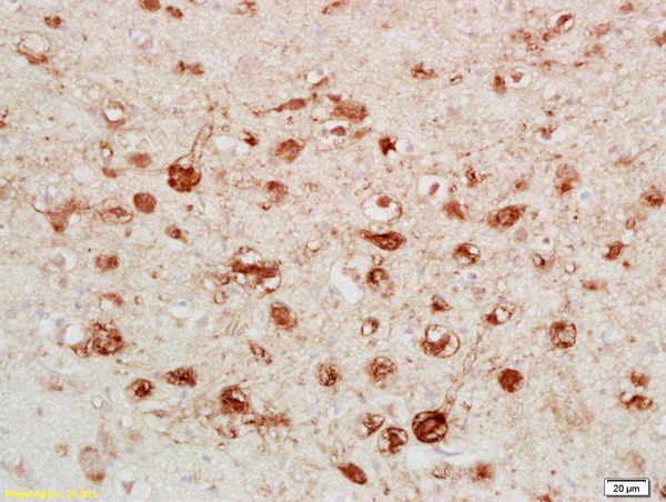 Formalin-fixed and paraffin embedded rat brain labeled with Anti-Calretinin/CA Polyclonal Antibody, Unconjugated (bs-0062R) followed by conjugation to the secondary antibody and DAB staining