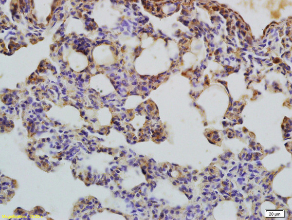 Formalin-fixed and paraffin embedded rat brain labeled with Rabbit Anti-LC3 Polyclonal Antibody, Unconjugated (bs-8878R) at 1:200 followed by conjugation to the secondary antibody (bs-0295G-HRP) and DAB staining.