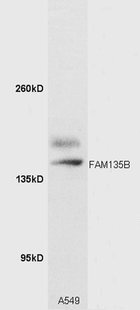 A549 cell lysates probed with Rabbit Anti-FAM135B Polyclonal Antibody (bs-9063R) at 1:300 overnight in 4˚C. Followed by conjugation to the secondary antibody (bs-0295G-HRP) at 1:5000 90min in 37˚C.