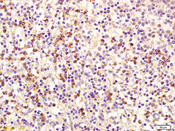 Formalin-fixed and paraffin embedded human spleen labeled with Rabbit Anti MCSF/M-CSF Polyclonal Antibody, Unconjugated (bs-4910R) at 1:200 followed by conjugation to the secondary antibody and DAB staining