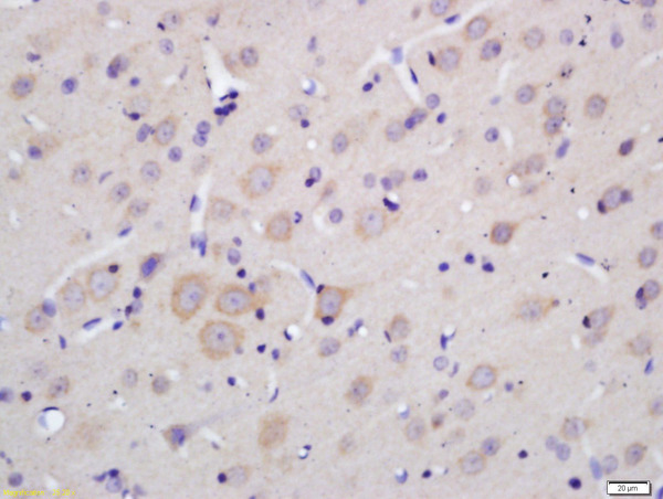 Formalin-fixed and paraffin embedded rat brain labeled with Anti-MOBP Polyclonal Antibody, Unconjugated (bs-11184R) at 1:200 followed by conjugation to the secondary antibody and DAB staining.\\n