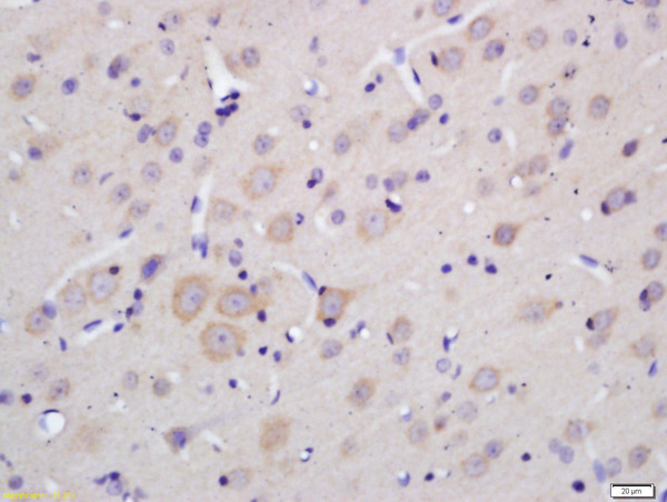 Formalin-fixed and paraffin embedded rat brain labeled with Anti-MOBP Polyclonal Antibody, Unconjugated (bs-11184R) at 1:200 followed by conjugation to the secondary antibody and DAB staining.\n