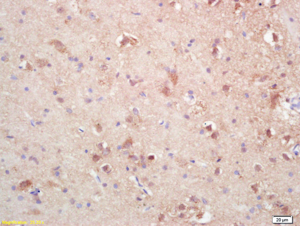 Formalin-fixed and paraffin embedded rat brain labeled with Rabbit Anti SOAT2/ACAT2 Polyclonal Antibody, Unconjugated (bs-5020R) at 1:200 followed by conjugation to the secondary antibody and DAB staining