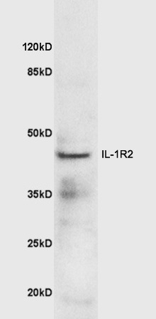 Mouse lung lysates probed with Anti-IL-1R2 Polyclonal Antibody (bs-2595R) at 1:300 overnight in 4˚C. Followed by conjugation to the secondary antibody (bs-0295G-HRP) at 1:5000 90min in 37˚C.\\n