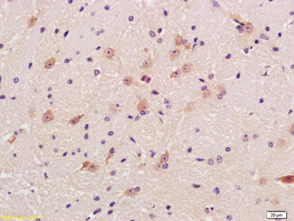 Mouse brain tissue probed with Anti-GAD65 + GAD67 Polyclonal Antibody (bs-13263R) at 1:300 overnight in 4˚C. Followed by conjugation to the secondary antibody (bs-0295G-HRP) at 1:5000 90min in 37˚C. 