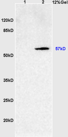 L1 rat intestine lysates L2 rat brain lysates probed with Anti SOAT2/ACAT2 Polyclonal Antibody, Unconjugated (bs-5020R) at 1:200 overnight at 4˚C. Followed by conjugation to secondary antibody (bs-0295G-HRP) at 1:3000 for 90 min at 37˚C. Predicted band 57kD. Observed band size:57kD.