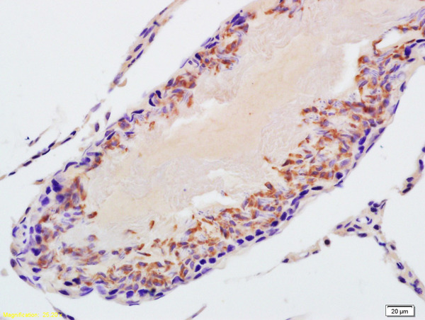 Formalin-fixed and paraffin embedded rat testis labeled with Rabbit Anti-STK31 Polyclonal Antibody, Unconjugated (bs-7051R) at 1:200 followed by conjugation to the secondary antibody and DAB staining