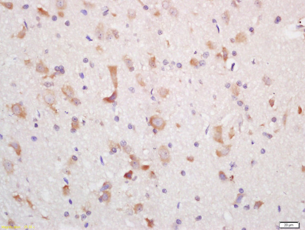 Formalin-fixed and paraffin embedded rat brain labeled with Rabbit Anti-MCHR Polyclonal Antibody, Unconjugated (bs-6626R) at 1:200 followed by conjugation to the secondary antibody and DAB staining