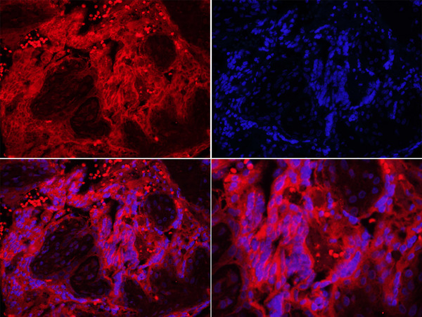 Formalin-fixed and paraffin embedded human placenta labeled with Rabbit Anti-TLR7 Polyclonal Antibody, Unconjugated (bs-6601R) at 1:200 followed by conjugation to the secondary antibody Goat Anti-Rabbit IgG, Cy3 conjugated(bs-0295G-Cy3) DAPI staining