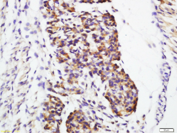 Formalin-fixed and paraffin embedded mouse embryo labeled with Rabbit Anti-Galectin 1 Polyclonal Antibody, Unconjugated (bs-6594R) at 1:200 followed by conjugation to the secondary antibody and DAB staining