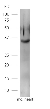 Mouse heart lysates probed with Rabbit Anti-FGF1 Polyclonal Antibody, Unconjugated (bs-0229R) at 1:300 overnight at 4˚C. Followed by a conjugated secondary antibody (bs-0295G-HRP) at 1:5000 for 90 min at 37˚C.